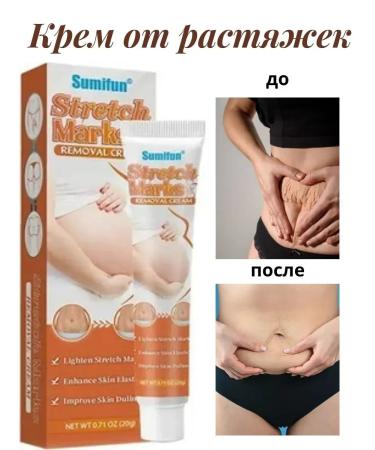 Nail25 beauty and health Sumifun stretch