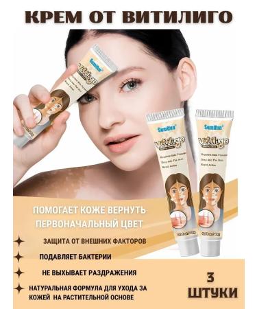 VALLEY Vitiligo face gel cream gel