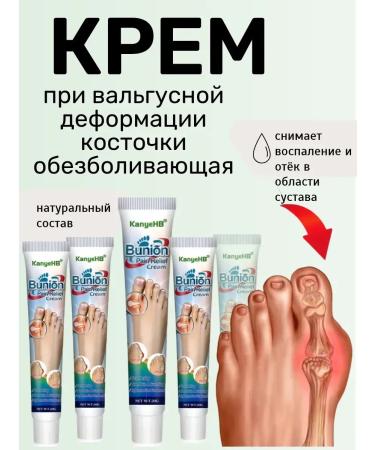 Gintensive Ointment with valgus deformation of the bone anesthetic