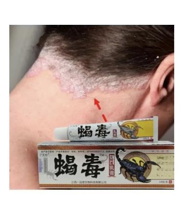 Gintensive Cream from the fungus of the skin between the fingers. From itching - Buy Online on GoSupps.com