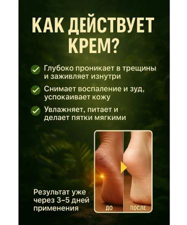 Gintensive Cream for dry skin of feet against cracks on the heels - Buy Online on GoSupps.com