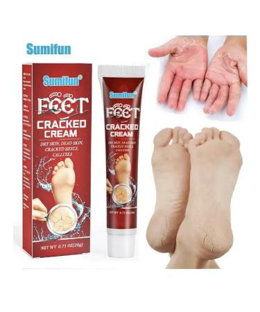 Gintensive Cream for dry skin of feet against cracks on the heels - Buy Online on GoSupps.com