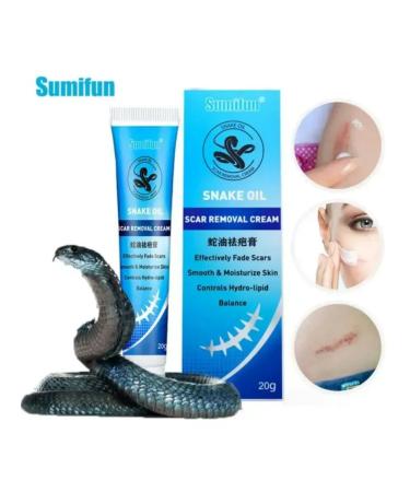 TikTok shop Cream for removing scars on the face Treatment of acne skin care - Buy Online on GoSupps.com