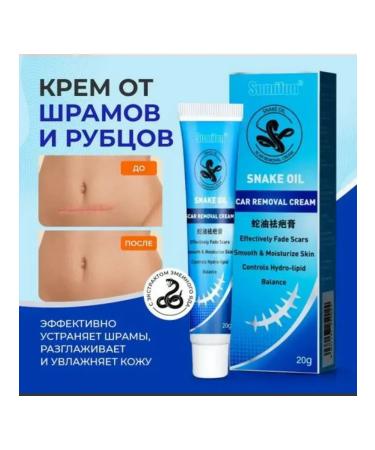 TikTok shop Cream for removing scars on the face Treatment of acne skin care - Buy Online on GoSupps.com