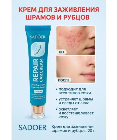 Life Ointment from scars and scars cream from scars after acne on the face