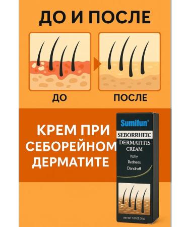 DK MILLION Cream from seborrheic dermatitis