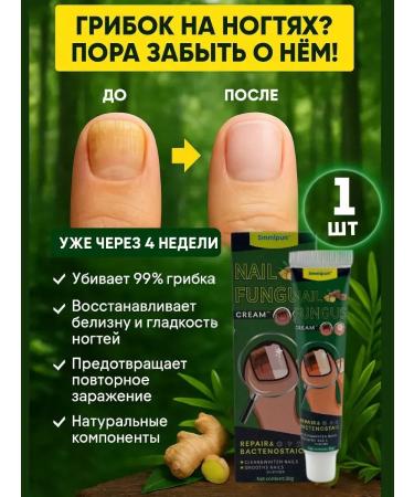 MILINABOSS Remedy for nail fungus eliminates darkening and itching 1pc