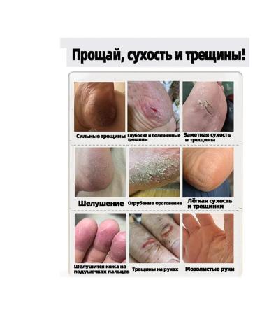 Cream from cracks on heels 250 ml - Buy Online on GoSupps.com