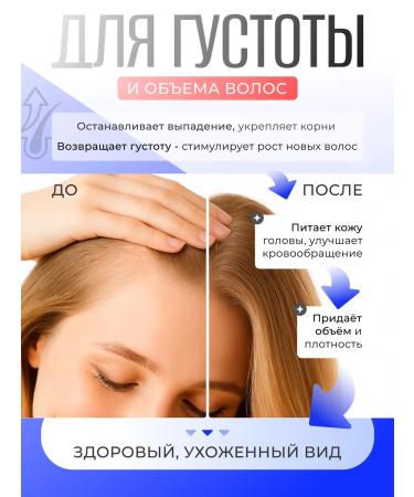 Hair growth Kopexidil - Buy Online on GoSupps.com