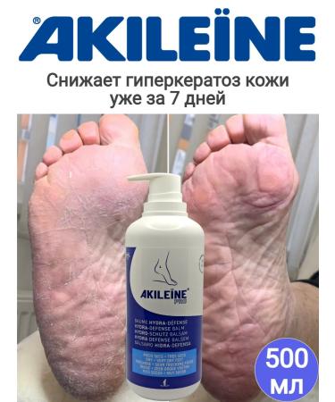 Akileine Foot balm water protection 500ml - Buy Online on GoSupps.com