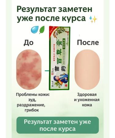 Baruch Chinese ointment antifungal - Buy Online on GoSupps.com