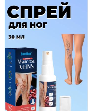 DavidSone Spray from varicose veins and removing fatigue in the legs