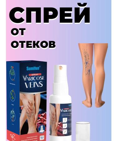 DavidSone Spray from varicose veins and removing fatigue in the legs - Buy Online on GoSupps.com