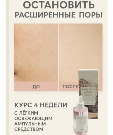 NAS2 Ampula Skin1004 Madagascar Centella ampoule - Buy Online on GoSupps.com