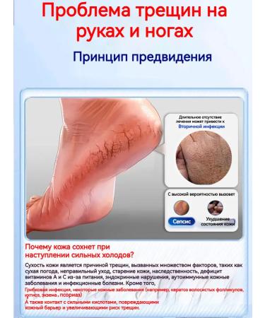 Cream from cracks on heels 50g - Buy Online on GoSupps.com