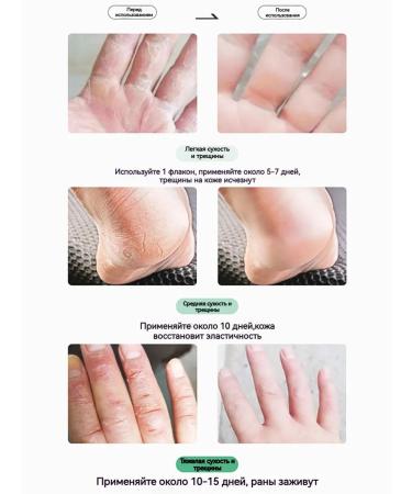 Cream from cracks on heels 50g - Buy Online on GoSupps.com