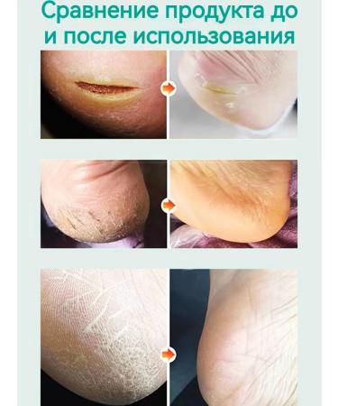 Cream from cracks on heels 50g - Buy Online on GoSupps.com