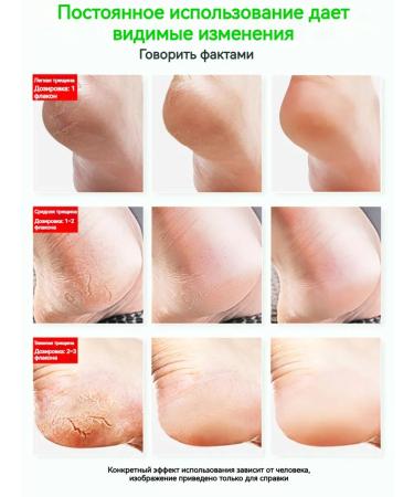 Cream from cracks on heels 50g - Buy Online on GoSupps.com