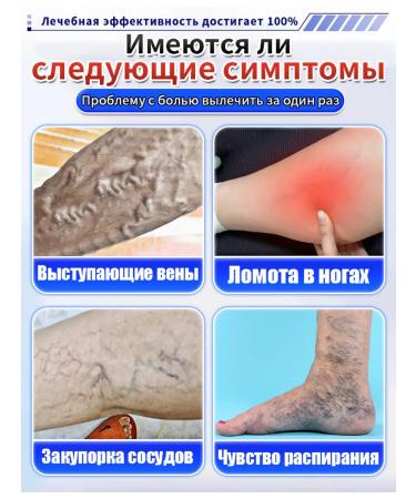 Cooperophage ointment from varicose veins - Buy Online on GoSupps.com