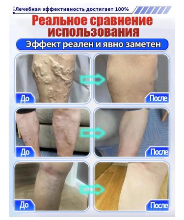 Cooperophage ointment from varicose veins - Buy Online on GoSupps.com