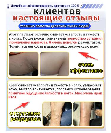 Cooperophage ointment from varicose veins - Buy Online on GoSupps.com