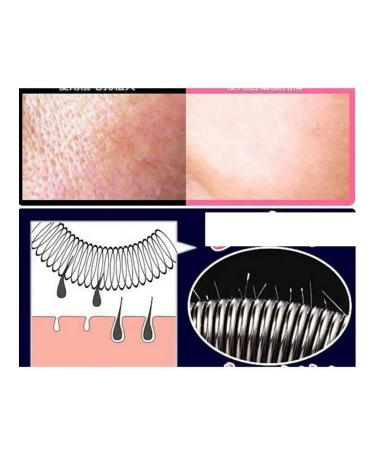 NT83 Women's facial epilator - Buy Online on GoSupps.com