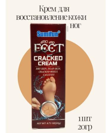 Bishi Cream from cracks on heels