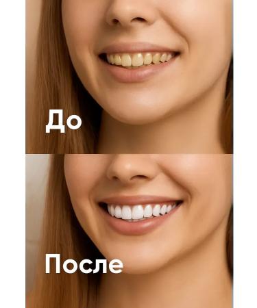 Dot Set of enzyme toothpastes - Buy Online on GoSupps.com