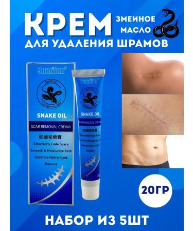 DASTAN2 Shrams Removing 5pcs