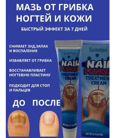 IMC Highly effective antifungal nail ointment