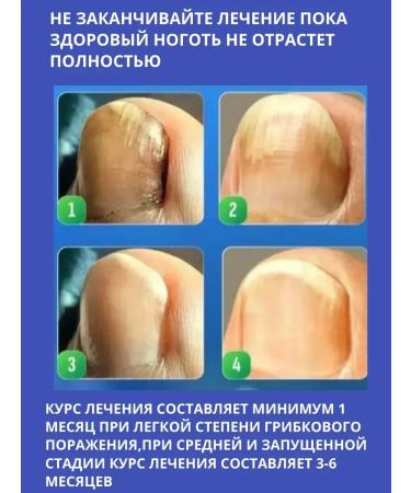 IMC Highly effective antifungal nail ointment - Buy Online on GoSupps.com