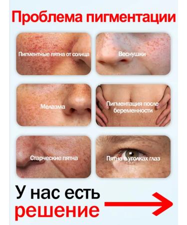 LYDIMOON Face cream end -leveling from age spots - Buy Online on GoSupps.com