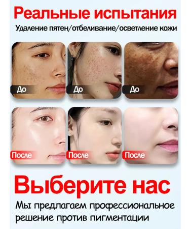 LYDIMOON Face cream end -leveling from age spots - Buy Online on GoSupps.com