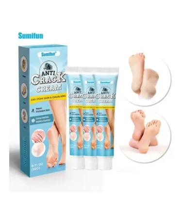 kupiDa Anti-Cream for Hands and Legs