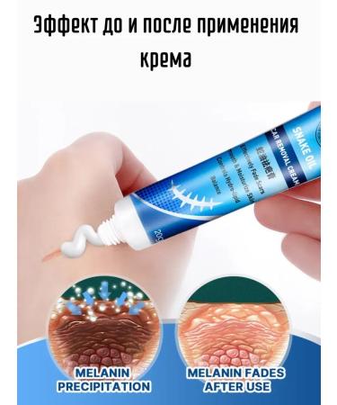 KEVO Cream against scars scars and stretch marks regenerating - Buy Online on GoSupps.com