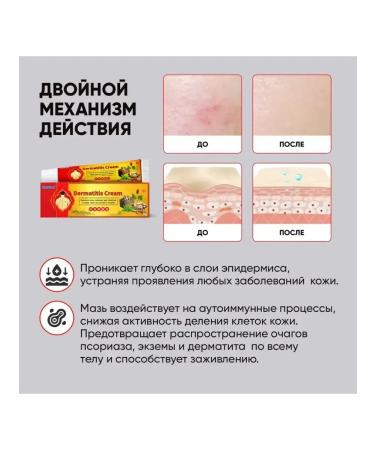 Below the baseboard Cream ointment from psoriasis and acne effective - Buy Online on GoSupps.com