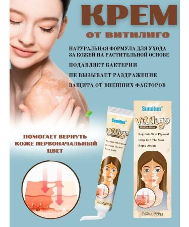 VALLEY Vitiligo cream for the body of the legs and arms cream against pigmentation