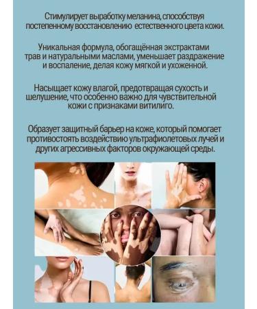 VALLEY Vitiligo cream for the body of the legs and arms cream against pigmentation - Buy Online on GoSupps.com