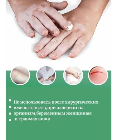 VALLEY Vitiligo cream for the body of the legs and arms cream against pigmentation - Buy Online on GoSupps.com