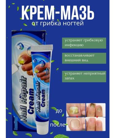 ABR Ointment from nail fungus and cracks with onychomycosis