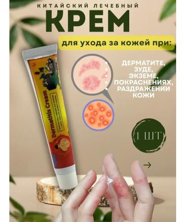 Ouch Skin care cream for eczema dermatitis