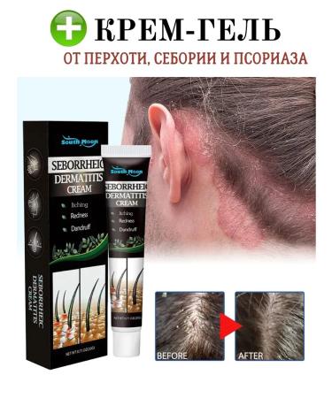 Black Friday Scalp with seborrheic dermatitis from dandruff - Buy Online on GoSupps.com