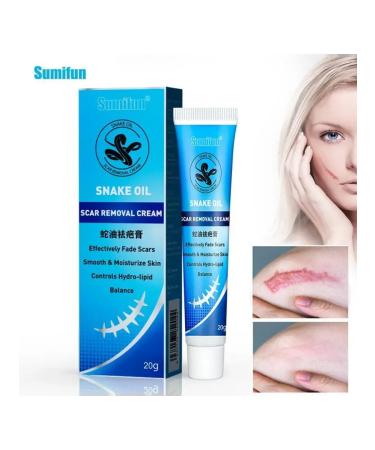 kupiDa Snake ointment for removing scars