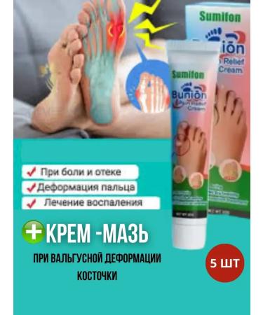 Below the baseboard Ointment with valgus deformation of the bone cream from gout