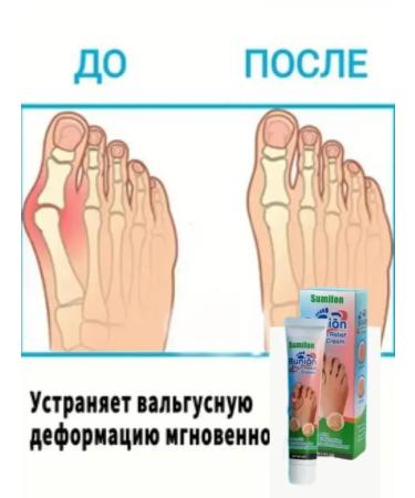 Below the baseboard Ointment with valgus deformation of the bone cream from gout - Buy Online on GoSupps.com
