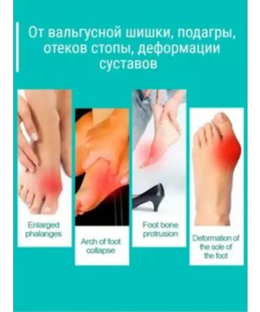 Below the baseboard Ointment with valgus deformation of the bone cream from gout - Buy Online on GoSupps.com