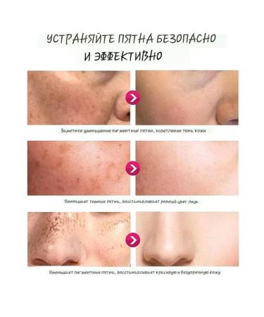 VALLEY Whitening cream for between the legs from the black spots of the knees of the elbows - Buy Online on GoSupps.com