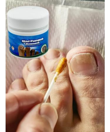 Golden Apple Chinese remedy for nail fungus 20 g - Buy Online on GoSupps.com