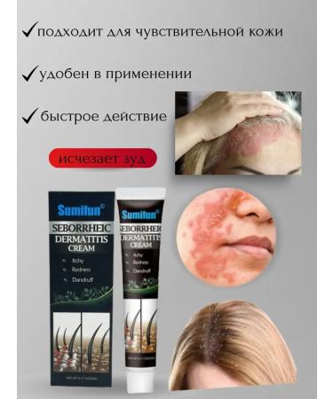 SLana2 Cream from seborrheic dermatitis 3pcs - Buy Online on GoSupps.com