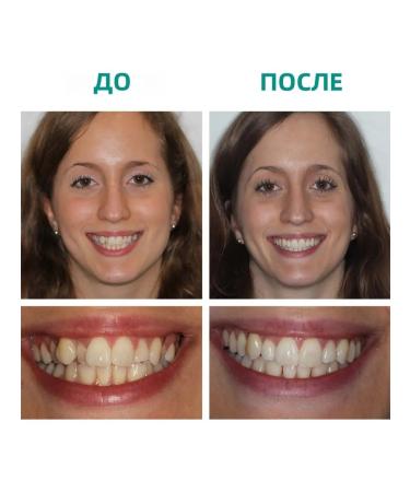 eelhoe mousse toothpaste whitening deep cleansing of the spot - Buy Online on GoSupps.com